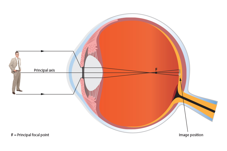 Ray diagram of a human eye